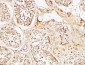 ALB Polyclonal Antibody